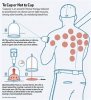 cupping.jpg