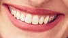 2017-04-20 10_27_37-Settings.png