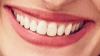 2017-04-20 10_27_37-Settings.png