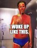 beach burn.jpg